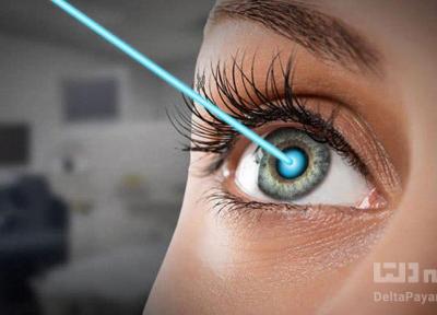 عمل لازک چشم چیست و چگونه انجام می شود؟